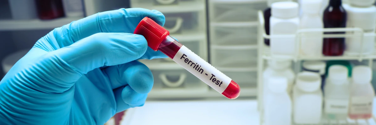 Ferritin im Fokus: Alles, was Sie über Ihren Eisenspeicher wissen müssen