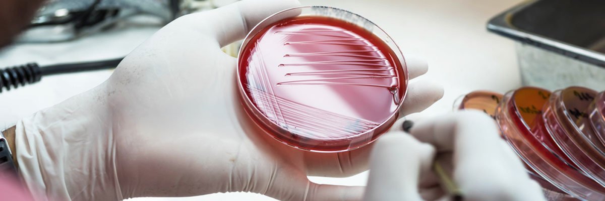 Antibiotika-resistente Bakterien: Wie werden sie zur globalen Katastrophe?