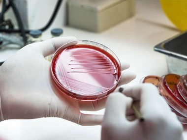 Antibiotica-resistente Bacteriën: Wereldwijde Catastrofe?