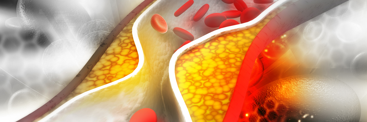 Die Cholesterin Lüge: Der größte Gesundheitsschwindel in der Geschichte 