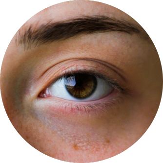 Ginkgo nel trattamento del glaucoma