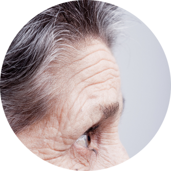 NAD+ und Alzheimer