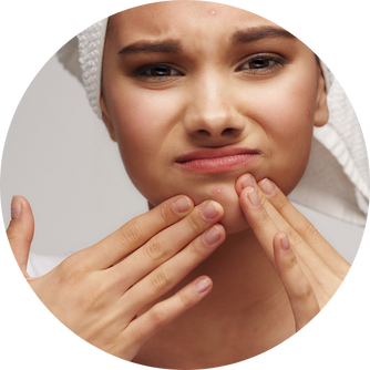 Capsule di zinco per il trattamento dell’acne